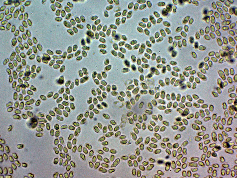 Un hydnoide corticale da identificare